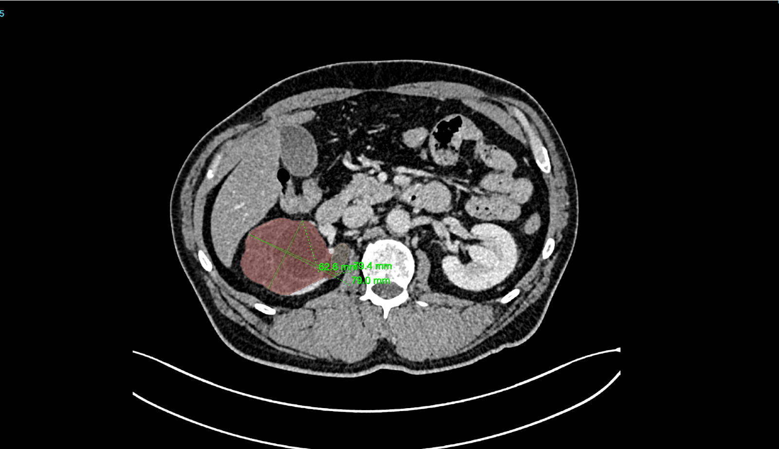 BM_Kidney_AI_product (1)