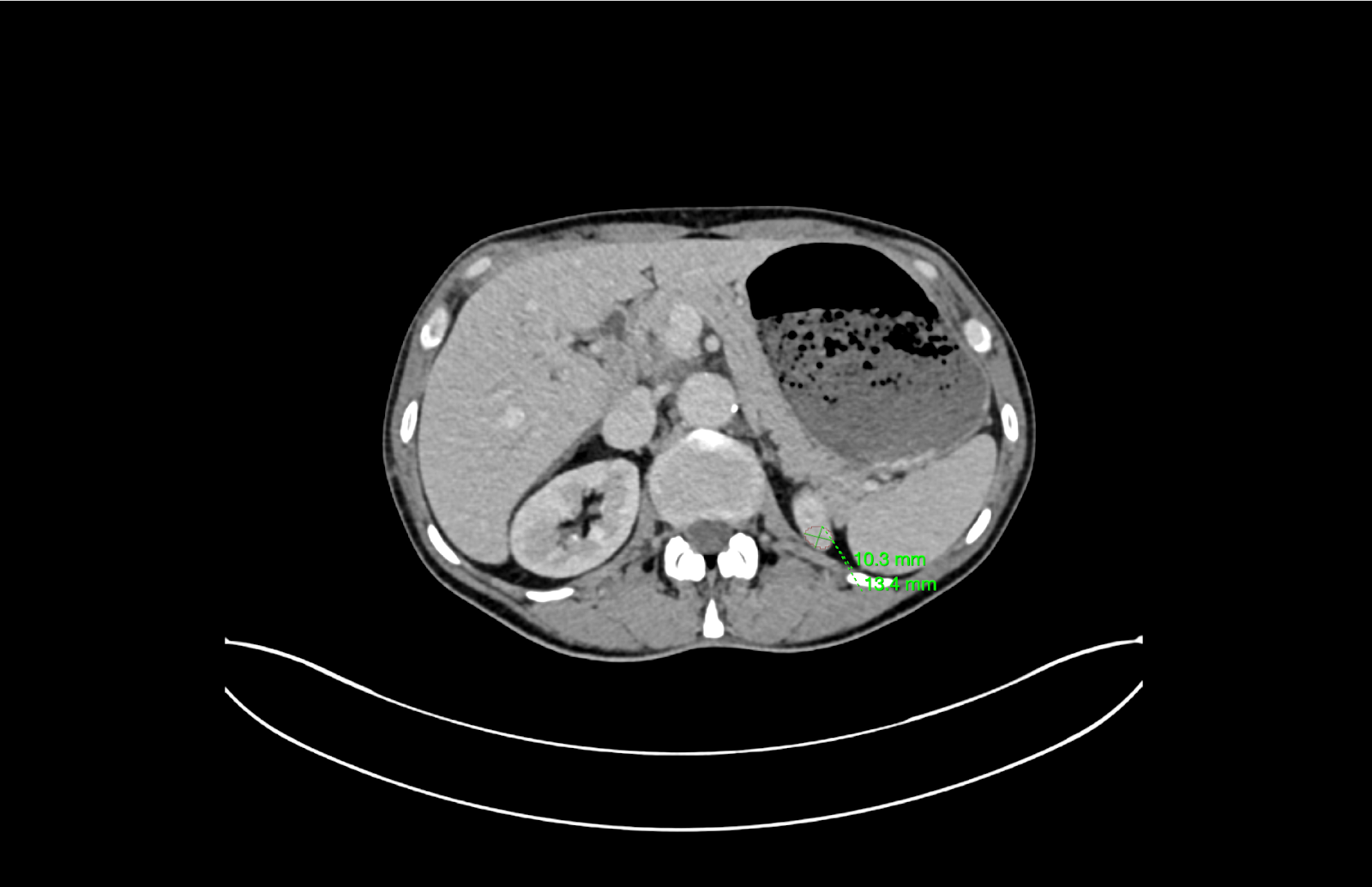 BM_Kidney_AI_product (2)